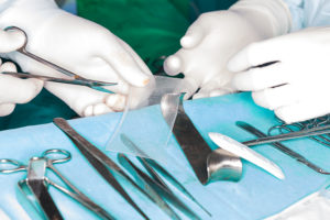 Hernia Mesh Lawsuit
