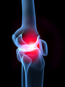 Hip & Knee Replacement