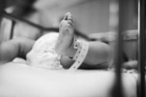 birth injury photo of baby with leg in the air with a tag on their leg